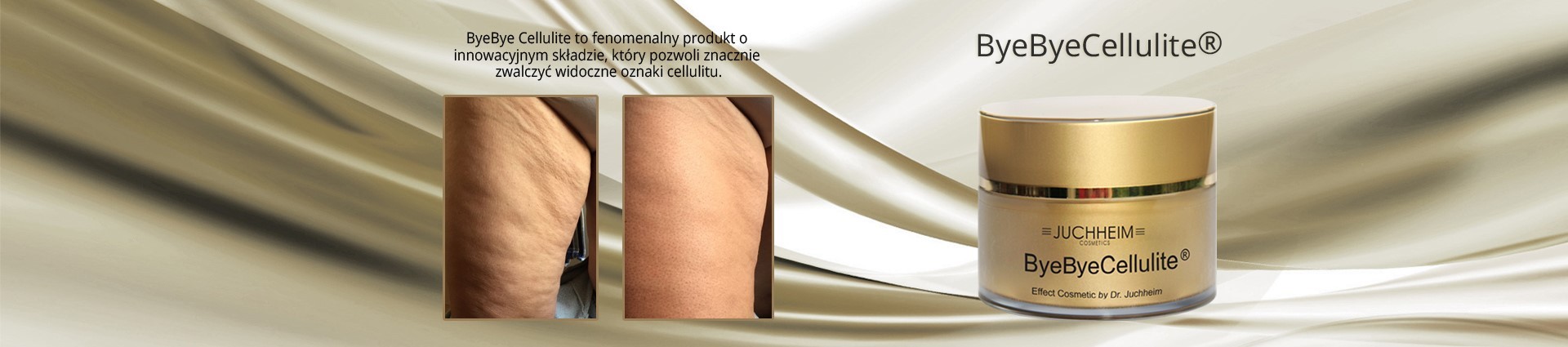 Cellulite